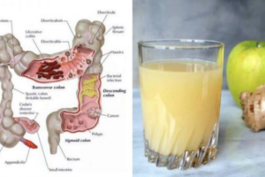 The 3 Juice Colon Cleanse: How Apple, Ginger and Lemon Can Flush Pounds of Toxins From Your Body