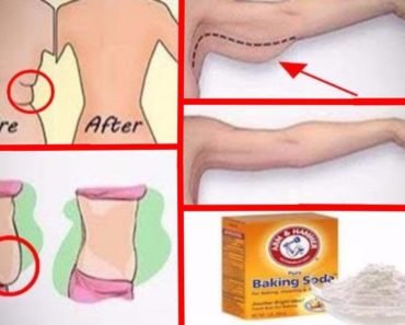How to Use Baking Soda to Get Rid of Belly, Arm, Thigh, and Back Fat